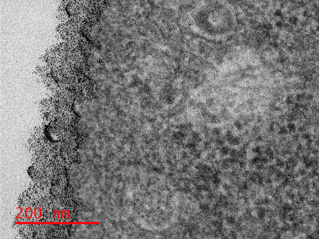 Membrane packing: In the Irvine lab, we are studying the interaction of amphiphilic gold nano particles (amph-NPs) and cell membrane interaction.Amph-NPs embed within lipid membranes and traverse into the cytosol subsequently. We investigate the effect of amph-NP's ligand structure and chemistry to better understand the role that governs the membrane penetration. This image shows short amphiphilic ligand protected amph-NPs labeling the glycocalyx of epithelium-derived cancer cell. By Yu-Sang Yang.