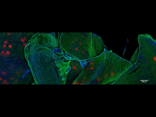 Polymer drug depots in the lungs and trachea. Intratracheal delivery was used to deposit polymer microparticle drug depots in the lungs of mice. The trachea is shown near the center of the image while lobes of the lung are shown behind/to the sides. Green: tomato lectin (endothelial staining); cyan: nuclei (DAPI); red: microparticles (DiD). By Greg Szeto/Adelaide Tovar 